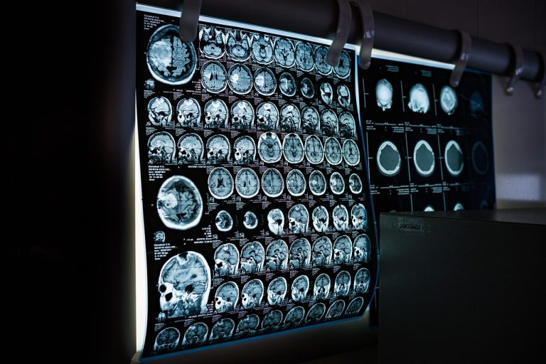 prima zi de concediu medical neplatita exceptii